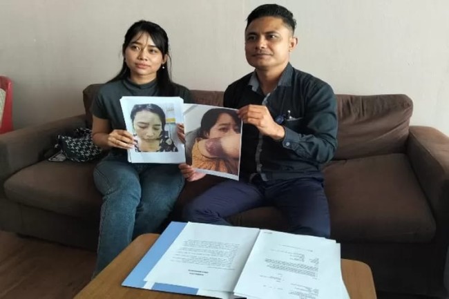 Kasus KDRT di Kupang: Anggota BIN Diduga Sebagai Pelaku, dan Bebas Berkeliaran